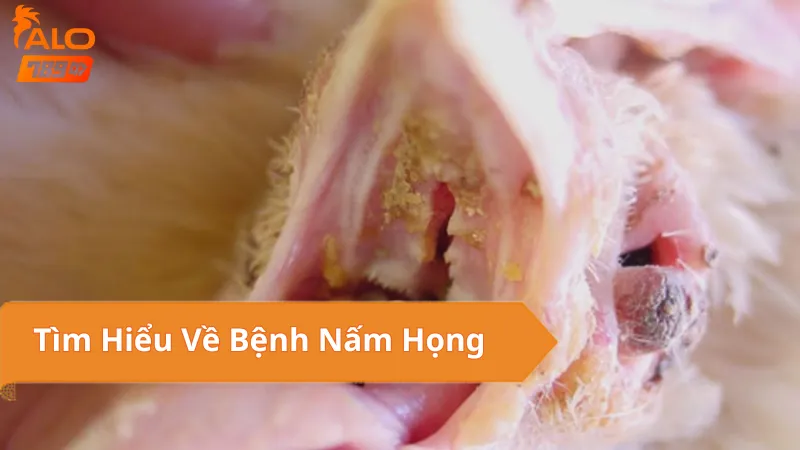 Bệnh Nấm Họng
